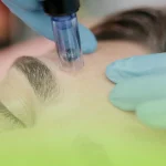 اگزوزوم تراپی