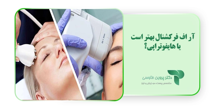 آر اف فرکشنال بهتر است یا هایفوتراپی؟