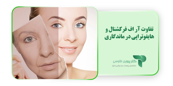 تفاوت آر اف فرکشنال و هایفوتراپی در ماندگاری