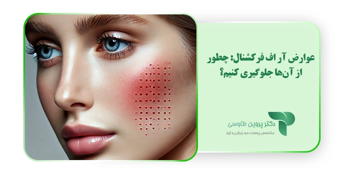عوارض آر اف فرکشنال: چطور از آن‌ها جلوگیری کنیم؟