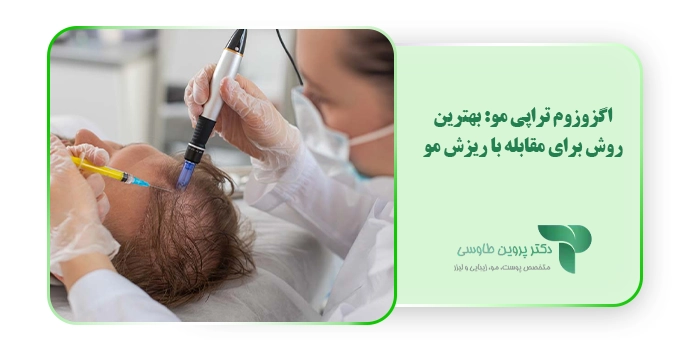 اگزوزوم تراپی مو: بهترین روش برای مقابله با ریزش مو