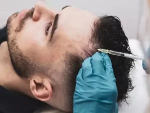 عوارض اگزوزوم تراپی مو