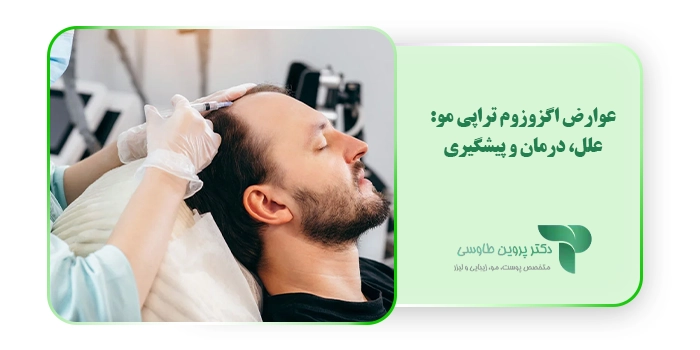 عوارض اگزوزوم تراپی مو: علل، درمان و پیشگیری 