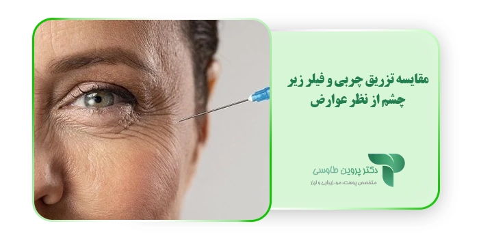 مقایسه تزریق چربی و فیلر زیر چشم از نظر عوارض