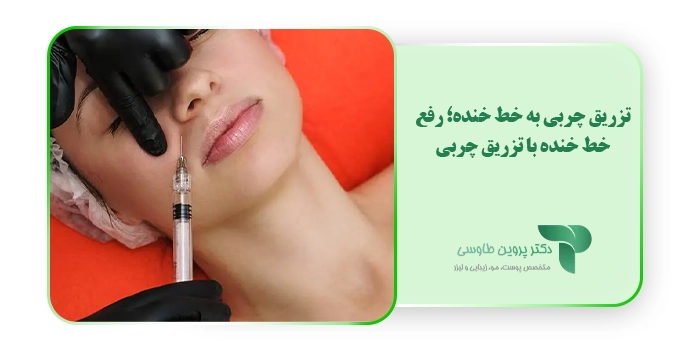 تزریق چربی به خط خنده؛ رفع خط خنده با تزریق چربی