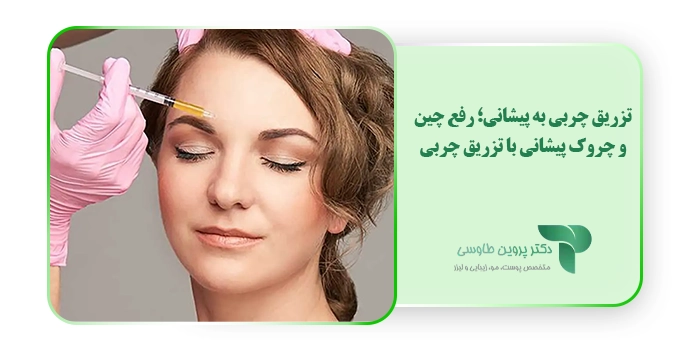 تزریق چربی به پیشانی؛ رفع چین و چروک پیشانی با تزریق چربی