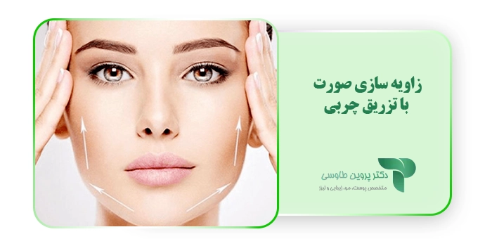 زاویه سازی صورت با تزریق چربی