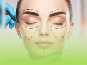 زاویه سازی صورت با تزریق چربی