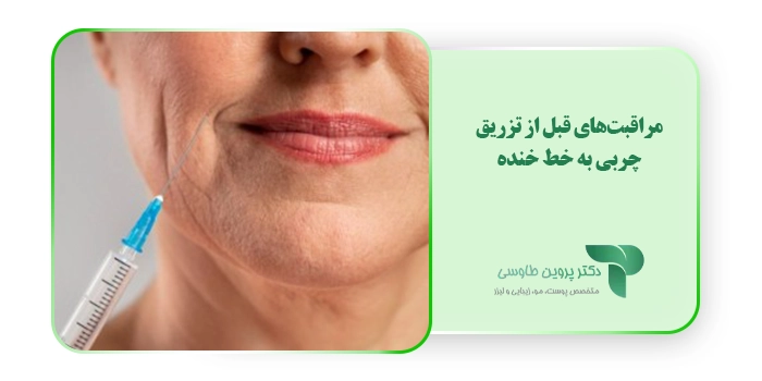 مراقبت‌های قبل از تزریق چربی به خط خنده