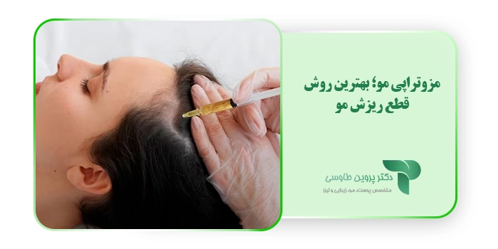 مزوتراپی مو؛ بهترین روش قطع ریزش مو