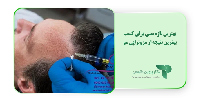 بهترین بازه سنی برای کسب بهترین نتیجه ایده‌آل از مزوتراپی مو