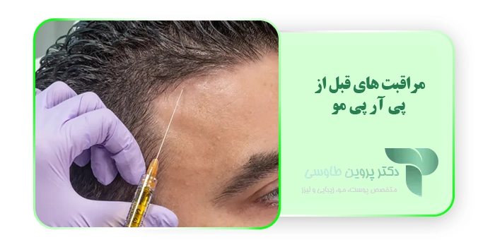 مراقبت های قبل از پی آر پی مو
