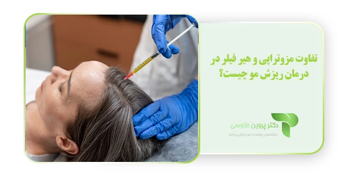 تفاوت مزوتراپی و هیر فیلر در درمان ریزش مو چیست؟