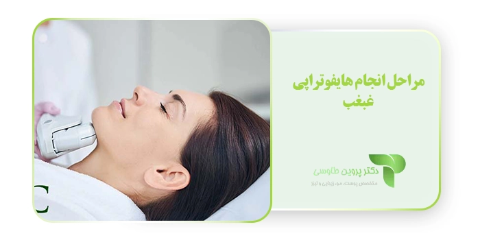 مراحل انجام هایفوتراپی غبغب