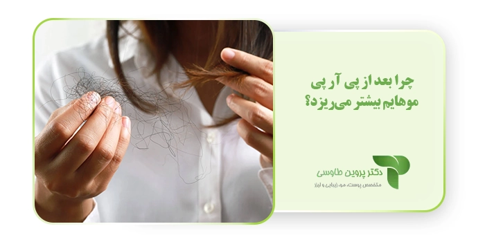 چرا بعد از پی آر پی موهایم بیشتر می‌ریزد؟
